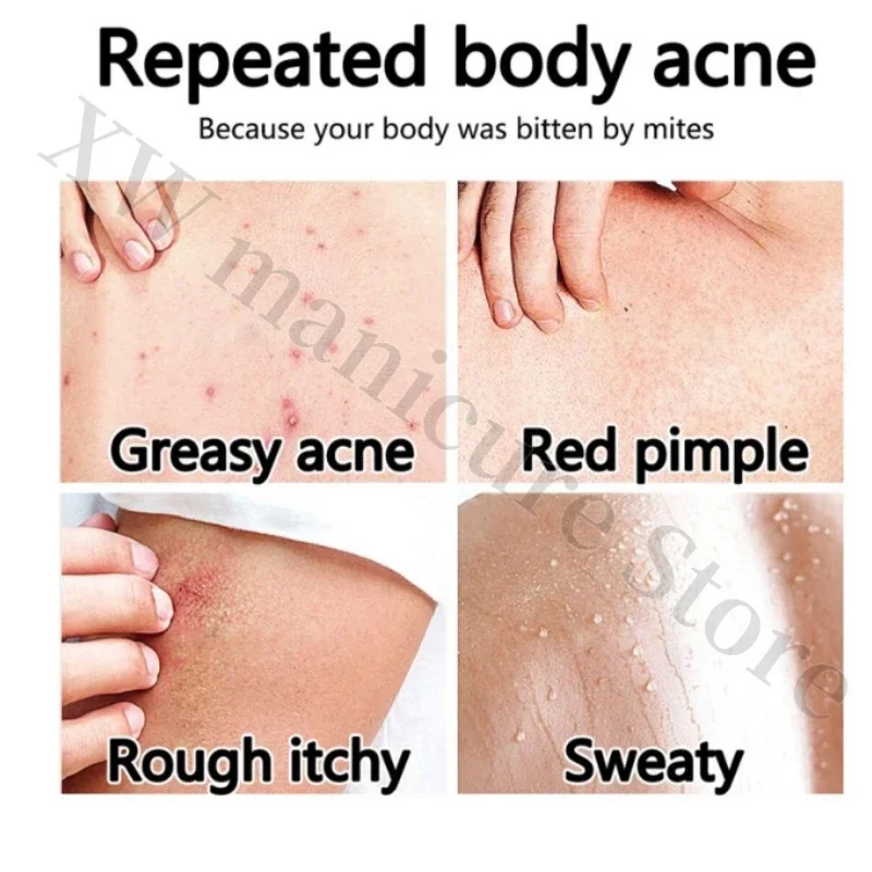 Vaseline Niacinamide Body Lotion Relieves Dry and Dehydrated Skin Exfoliates and Brightens Skin Tone Hydrating Body Lotion Vaseline Niacinamide Body Lotion Relieves Dry and Dehydrated Skin Exfoliates and Brightens Skin Tone Hydrating Body Lotion