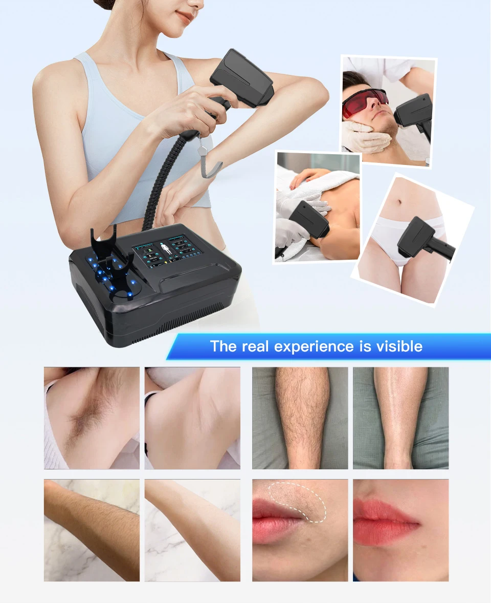 Factory Selling Diode Laser 808nm Hair Removal Machine Depilation Bikini Facial Whitening Rejuvenating Professional Big Power Be Factory Selling Diode Laser 808nm Hair Removal Machine Depilation Bikini Facial Whitening Rejuvenating Professional Big Power Be